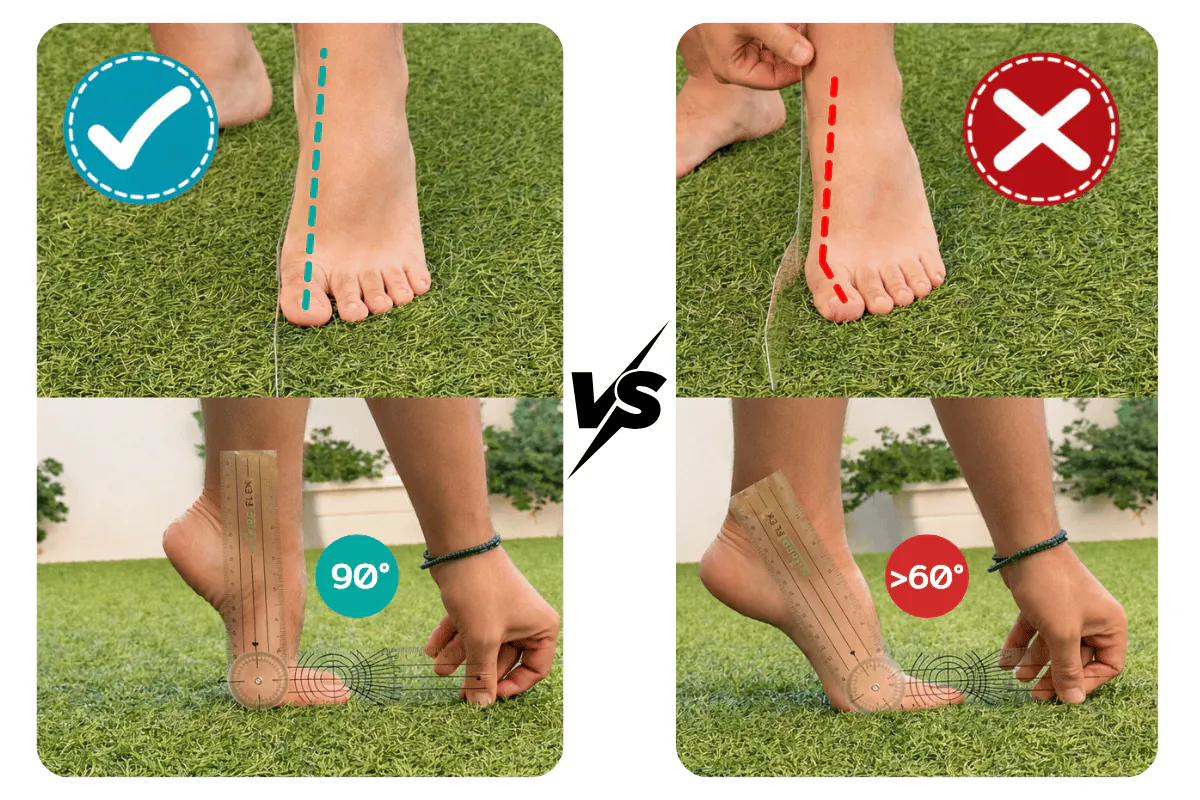 Illustration: How Toe Misalignment Ruins Your Gait