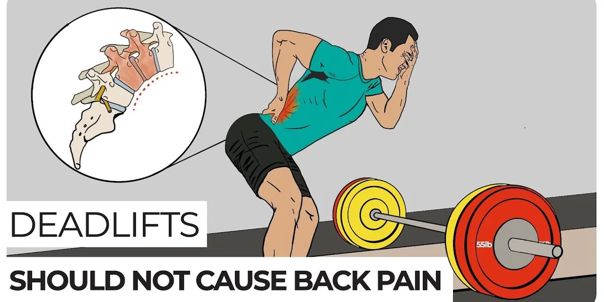 The Cause of Lower Back Pain After Deadlifts