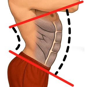 Anterior pelvic tilt posture