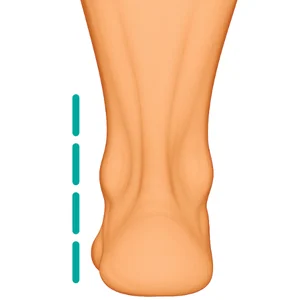 Controlled Pronation